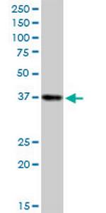 SORD Antibody in Western Blot (WB)