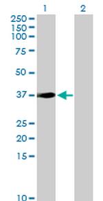 SORD Antibody in Western Blot (WB)