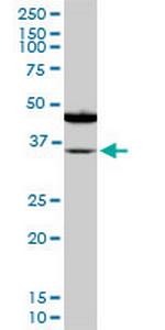 SORD Antibody in Western Blot (WB)