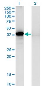 SORD Antibody in Western Blot (WB)