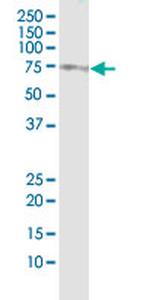 SOX9 Antibody in Immunoprecipitation (IP)