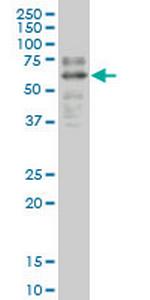 SOX9 Antibody in Western Blot (WB)