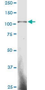 SP3 Antibody in Western Blot (WB)