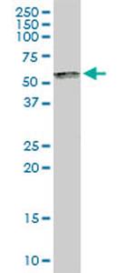 SP100 Antibody in Western Blot (WB)