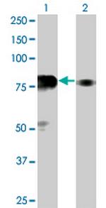 SP100 Antibody in Western Blot (WB)