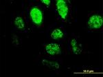 SPI1 Antibody in Immunocytochemistry (ICC/IF)