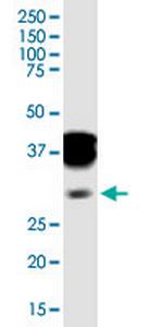 SPI1 Antibody in Western Blot (WB)