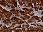 SPINK1 Antibody in Immunohistochemistry (Paraffin) (IHC (P))