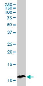 SPINK1 Antibody in Western Blot (WB)