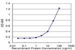 SPINK1 Antibody in ELISA (ELISA)