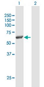 SRC Antibody in Western Blot (WB)