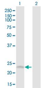 SRD5A1 Antibody in Western Blot (WB)