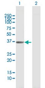 AKR1D1 Antibody in Western Blot (WB)