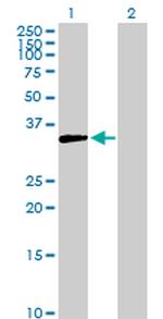 AKR1D1 Antibody in Western Blot (WB)