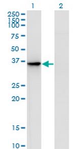 AKR1D1 Antibody in Western Blot (WB)