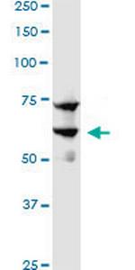 SREBF1 Antibody in Western Blot (WB)