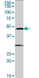 SRF Antibody in Western Blot (WB)