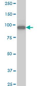 SRPK1 Antibody in Western Blot (WB)