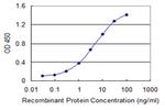 SSTR1 Antibody in ELISA (ELISA)