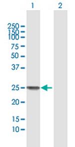 SSX1 Antibody in Western Blot (WB)