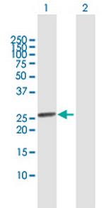 SSX1 Antibody in Western Blot (WB)