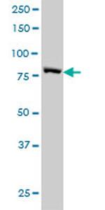 STAT3 Antibody in Western Blot (WB)