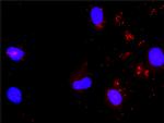 STAT5A Antibody in Proximity Ligation Assay (PLA) (PLA)