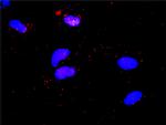 STAT5A Antibody in Proximity Ligation Assay (PLA) (PLA)