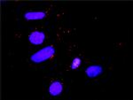 STAT5B Antibody in Proximity Ligation Assay (PLA) (PLA)