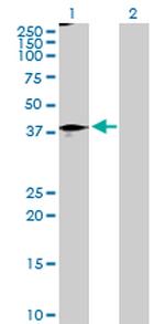 STAT5B Antibody in Western Blot (WB)