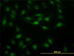 STAT5B Antibody in Immunocytochemistry (ICC/IF)