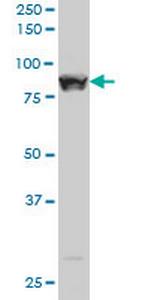 STAT5B Antibody in Western Blot (WB)