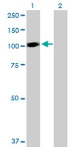 STAT6 Antibody in Western Blot (WB)