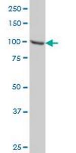 STAT6 Antibody in Western Blot (WB)