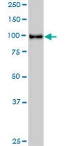 STAT6 Antibody in Western Blot (WB)