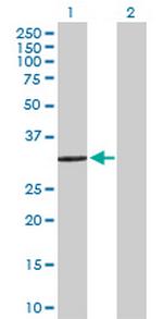 SULT1E1 Antibody in Western Blot (WB)