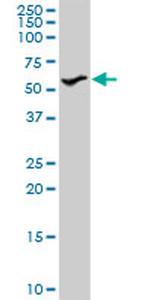 STK3 Antibody in Western Blot (WB)