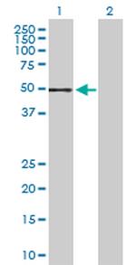 STK3 Antibody in Western Blot (WB)