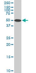 STK4 Antibody in Western Blot (WB)