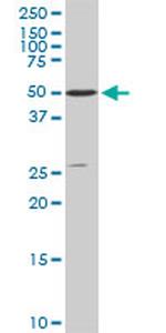 STK4 Antibody in Western Blot (WB)