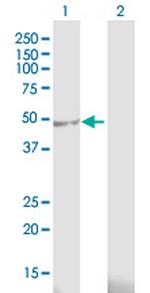 AURKA Antibody in Western Blot (WB)