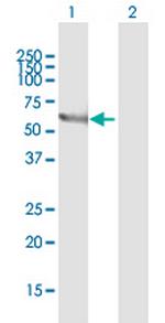 STXBP1 Antibody in Western Blot (WB)