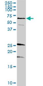 STXBP1 Antibody in Western Blot (WB)