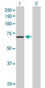 STXBP1 Antibody in Western Blot (WB)