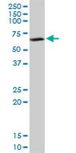 SUOX Antibody in Western Blot (WB)