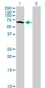 SUOX Antibody in Western Blot (WB)