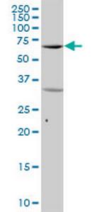 SYK Antibody in Western Blot (WB)