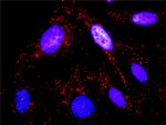 SYK Antibody in Proximity Ligation Assay (PLA) (PLA)