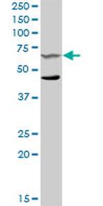 SYK Antibody in Western Blot (WB)