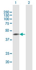 T Antibody in Western Blot (WB)